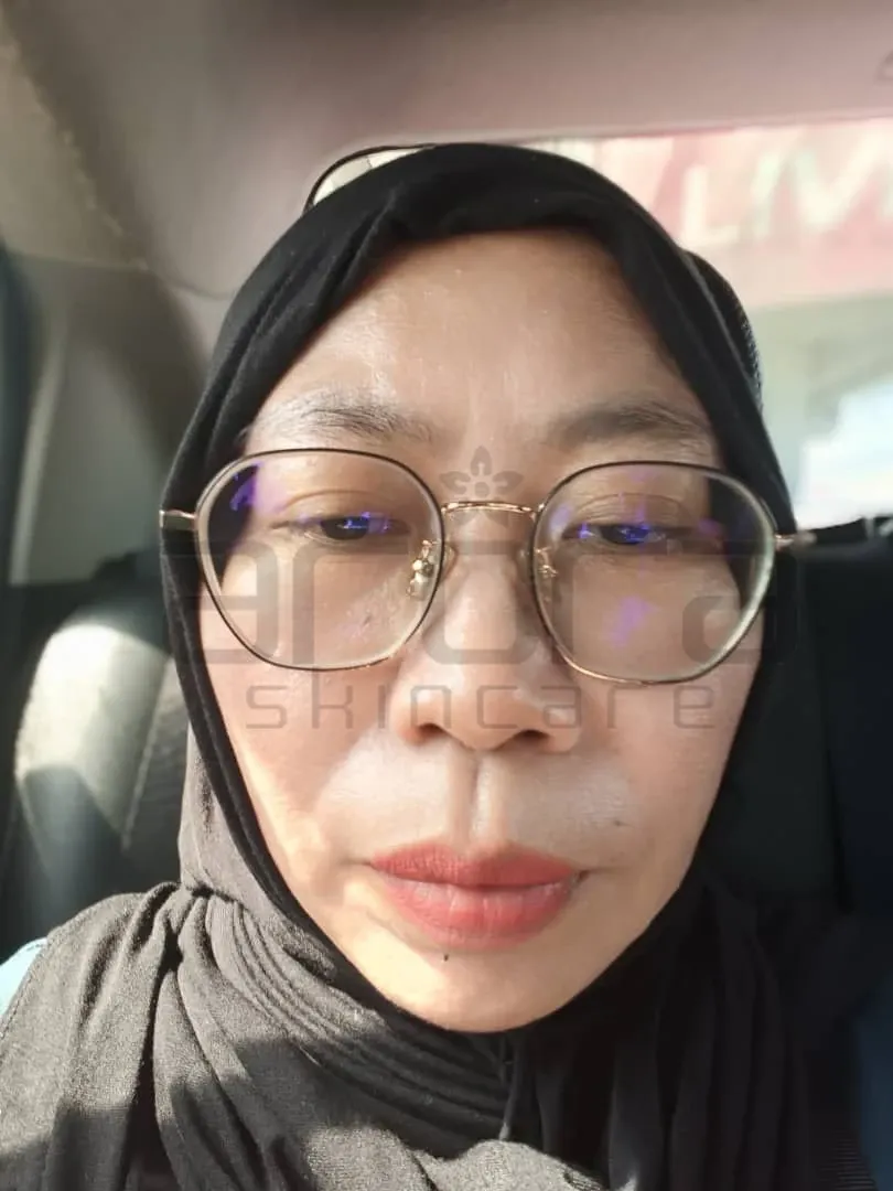 Terkini