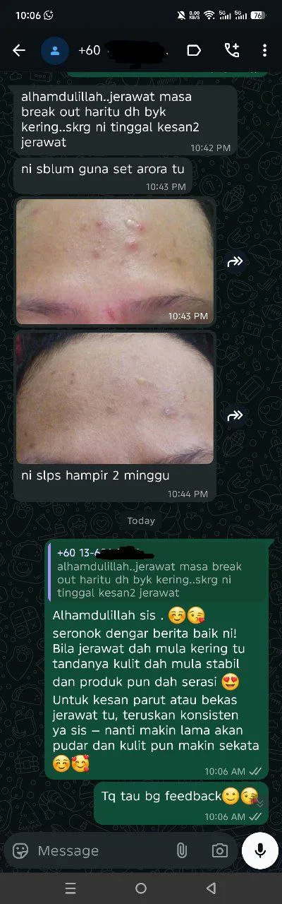 Perkongsian asal Perkongsian pelanggan: Pelanggan berkongsi gambar perkembangan breakout dalam perbualan WhatsApp.