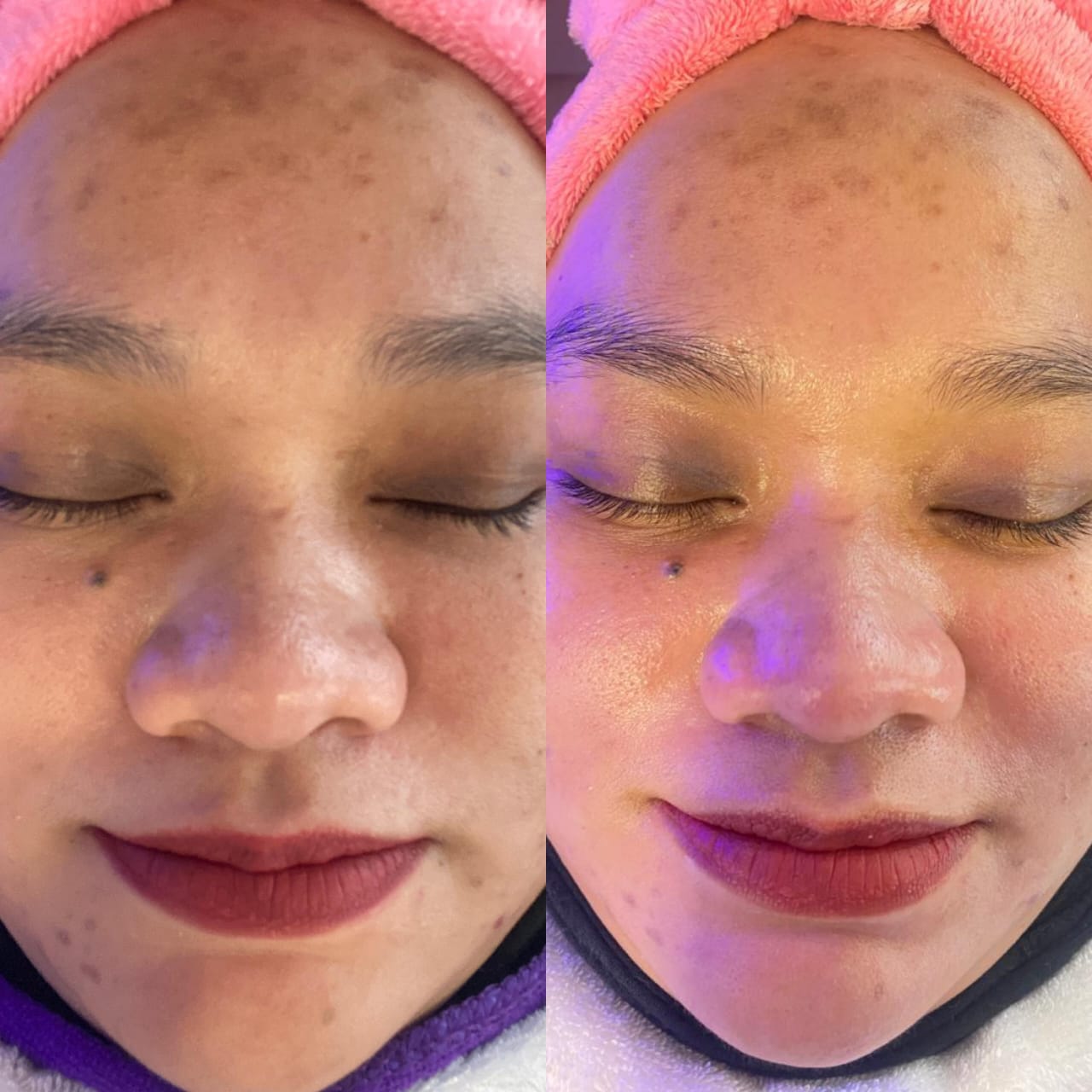 Hasil Pelanggan Arora Spa 5
