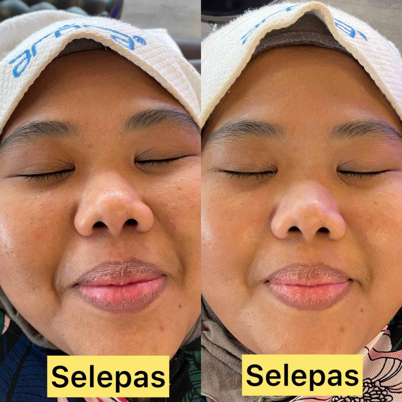 Hasil Pelanggan Arora Spa 4