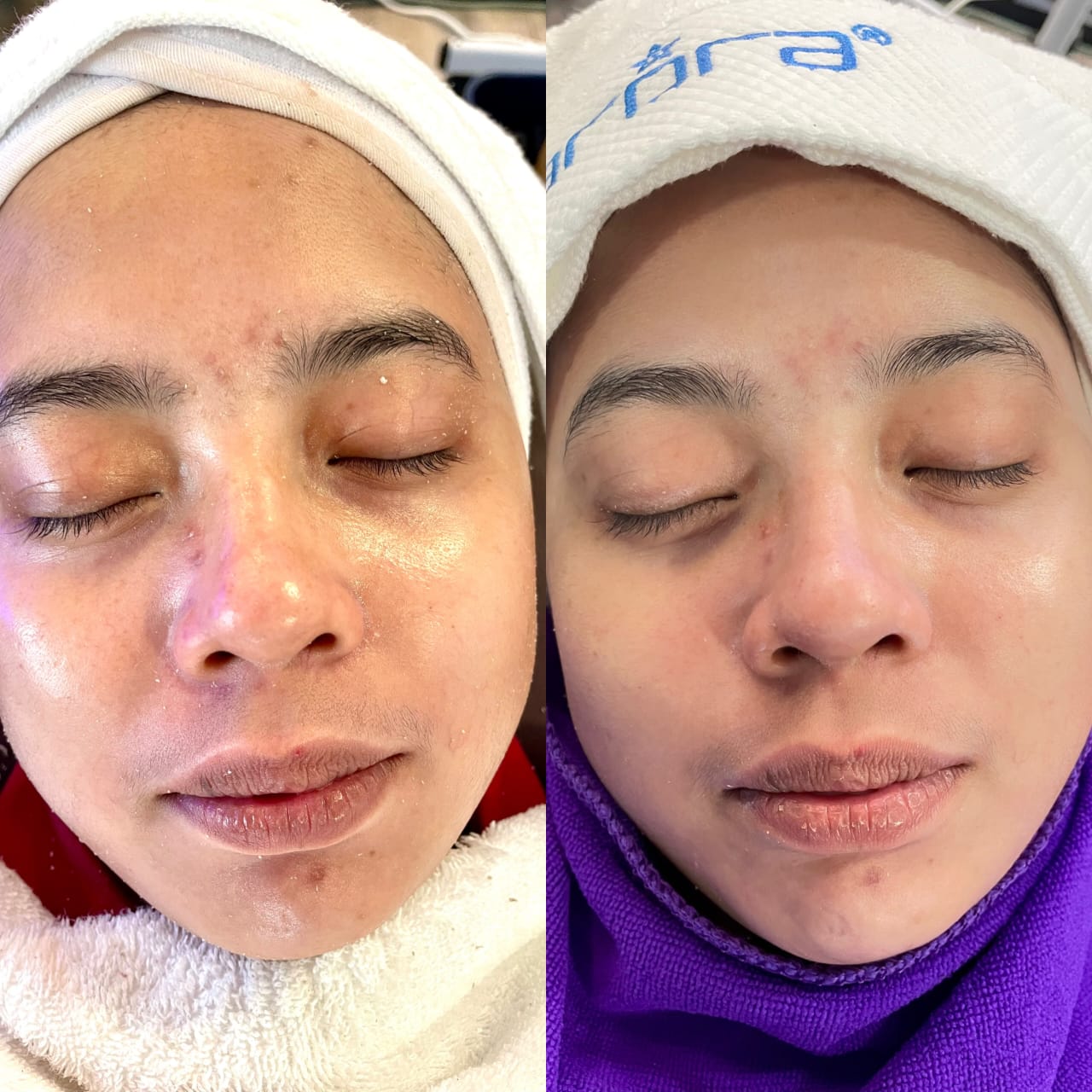 Hasil Pelanggan Arora Spa 2