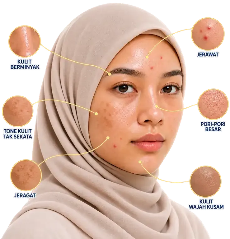 Masalah wajah biasa: jeragat, jerawat, dan kulit kusam