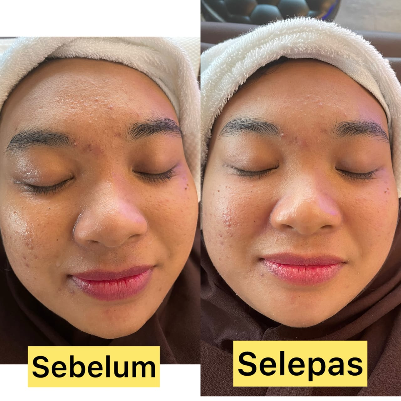 Hasil Pelanggan Arora Spa 6