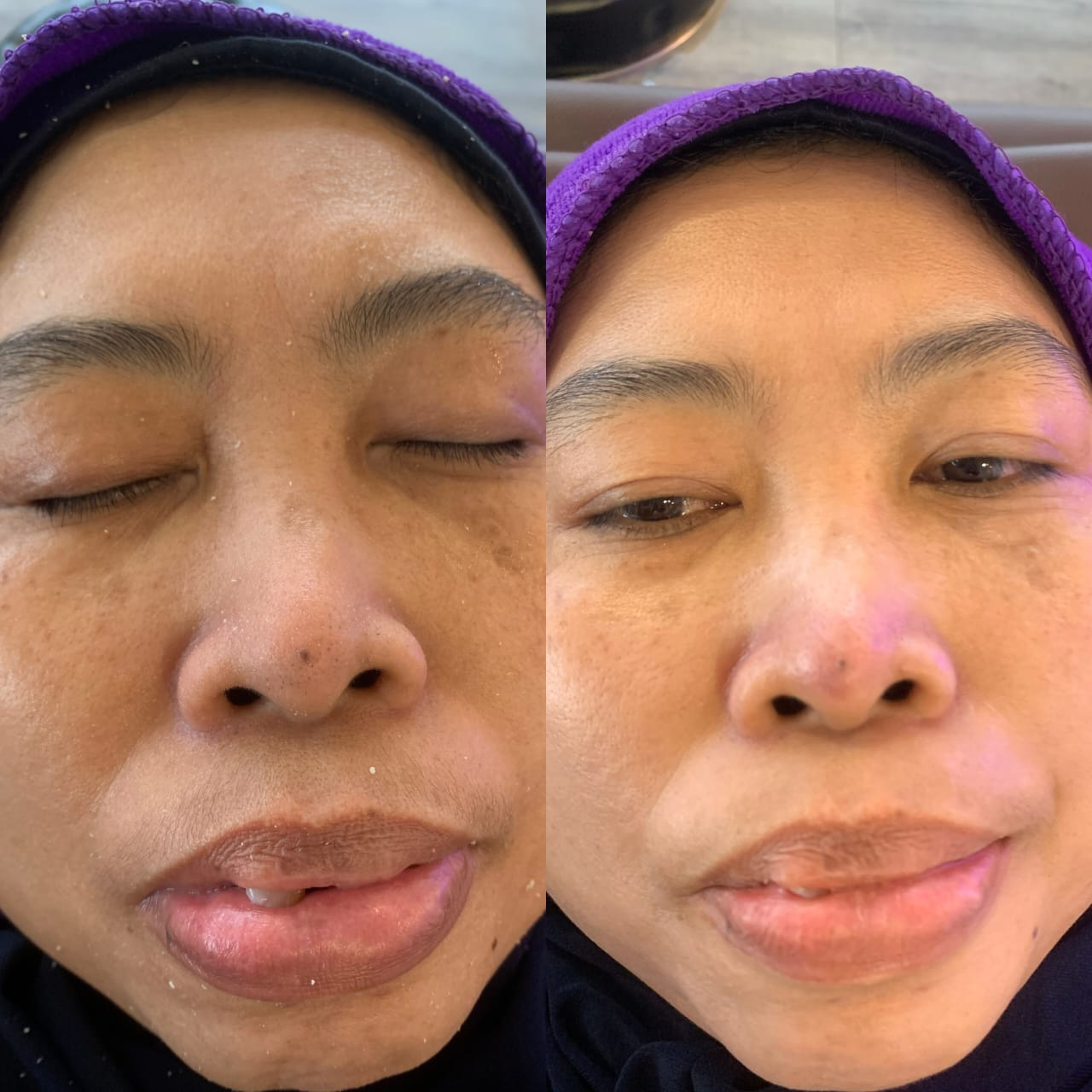 Hasil Pelanggan Arora Spa 1