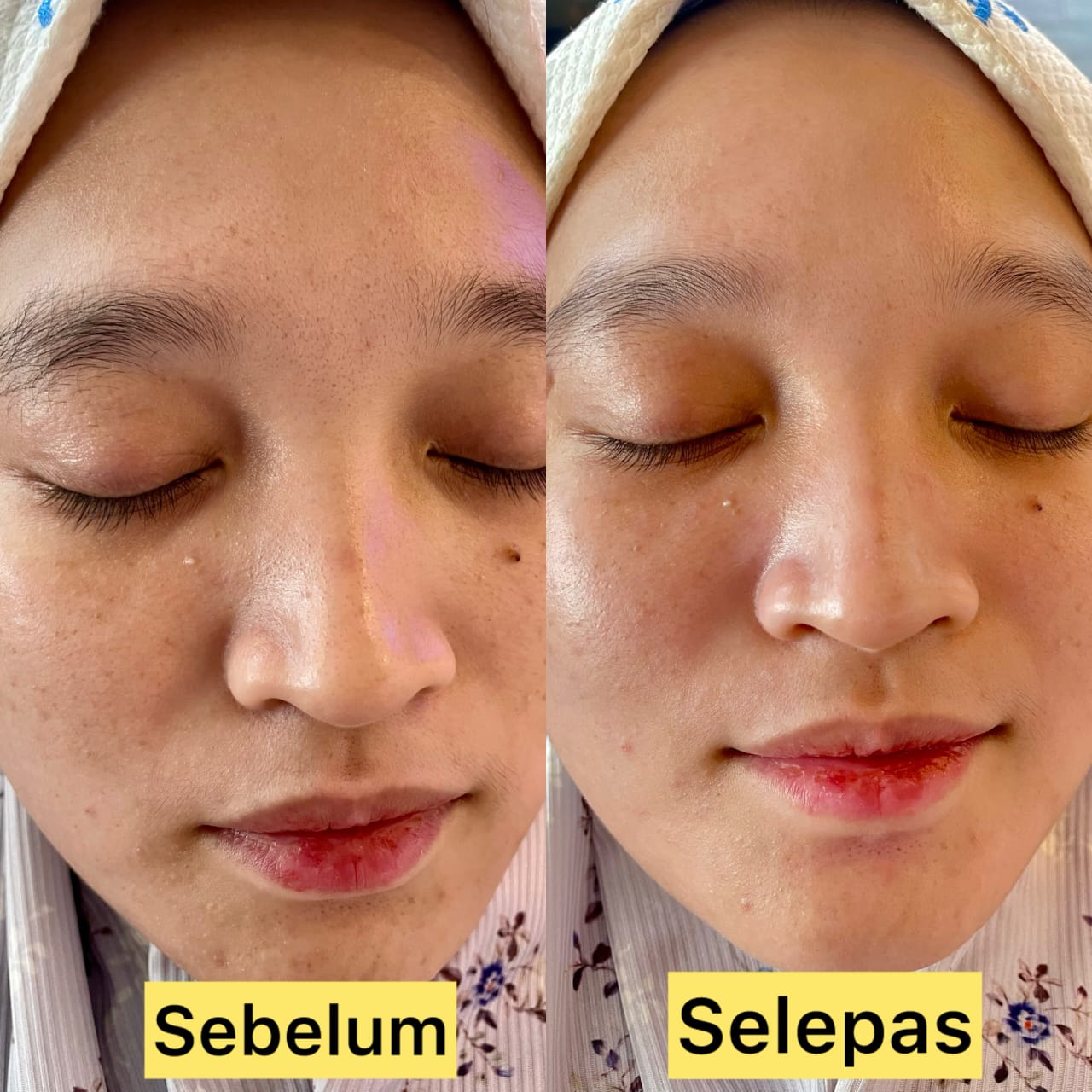 Hasil Pelanggan Arora Spa 3