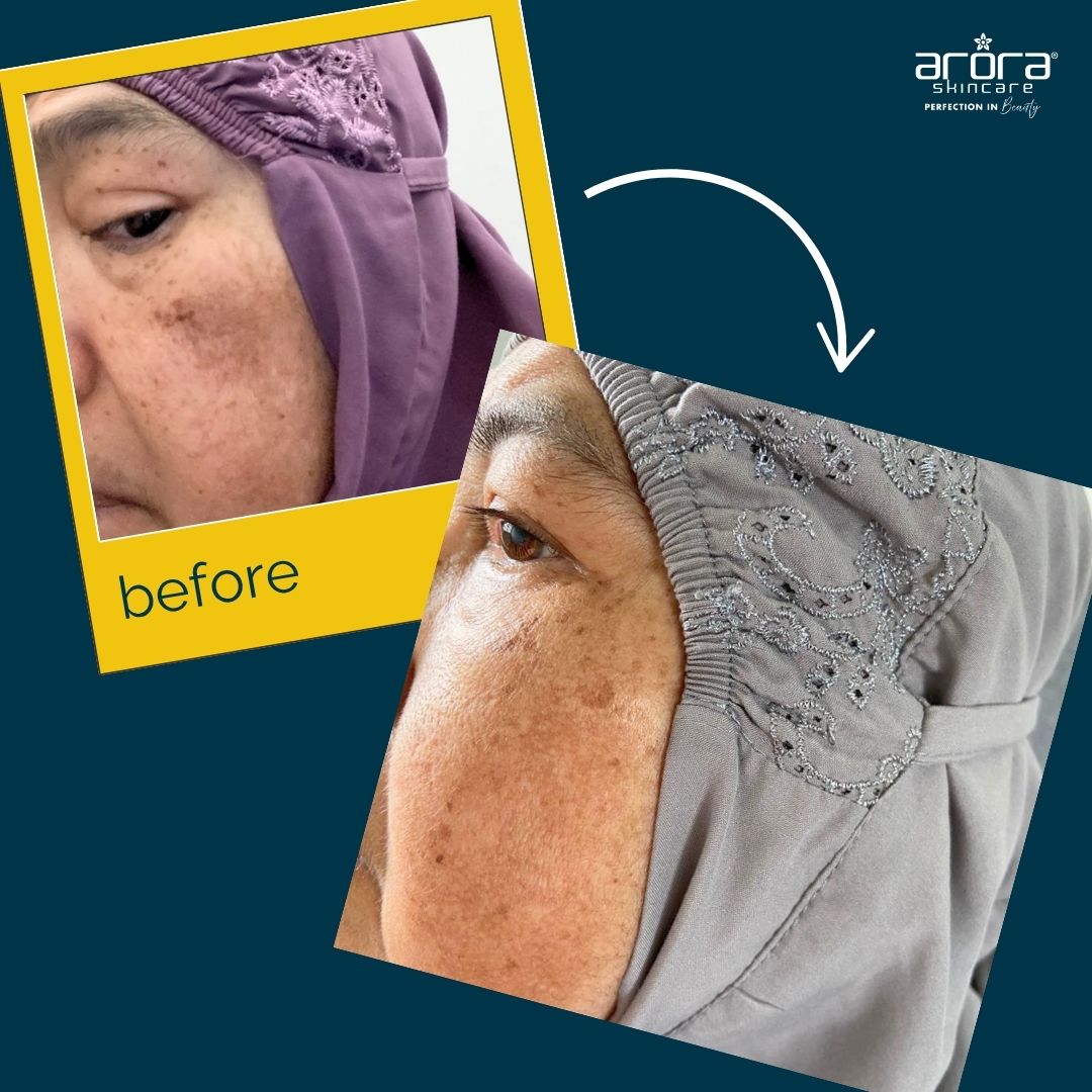 Featured Result: Jeragat