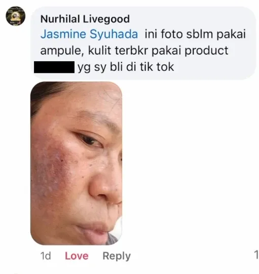 Sebelum