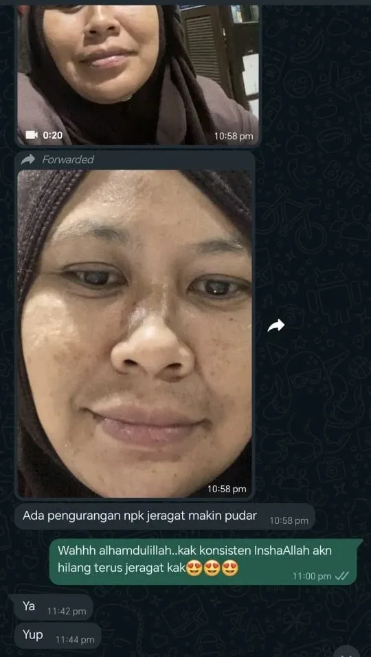 Sebelum