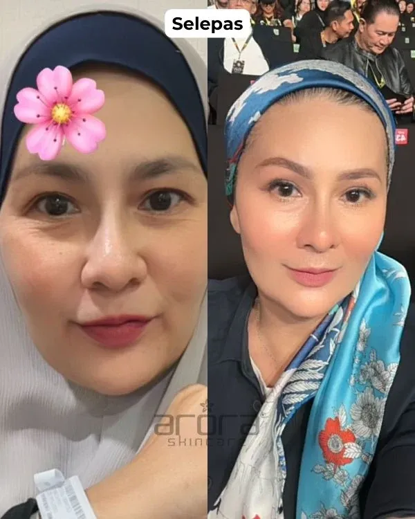 Kesan